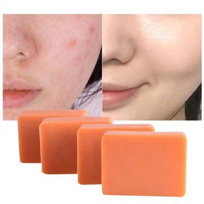 Kojic Asid Netwayaj Bar Savon